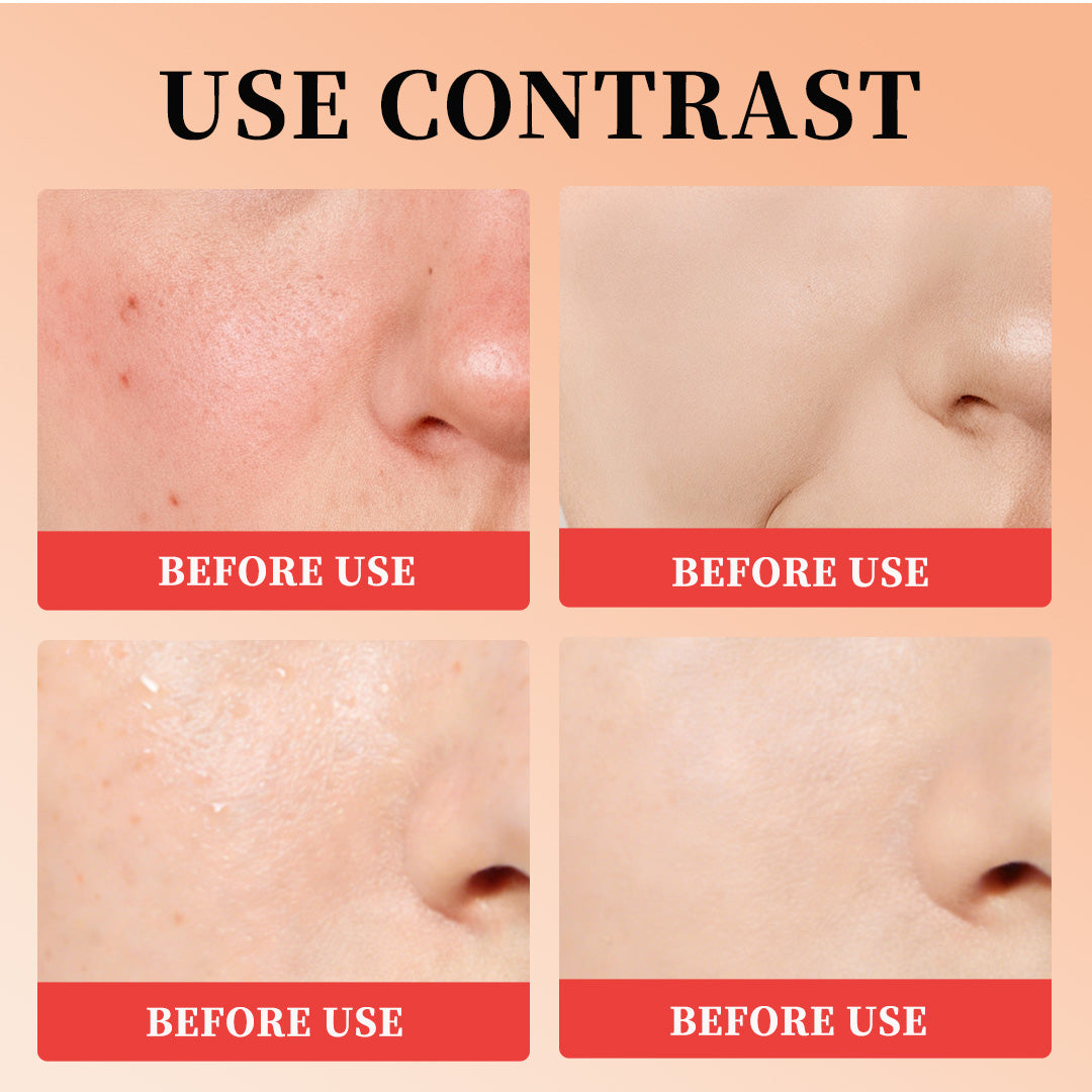 Van Chu Yan - Hydrating Essence Set