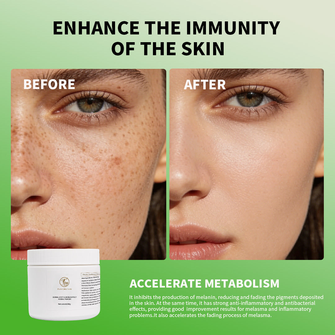 Fan Chu Yan - Dermal Spot Traditional Chinese Medicine Powder