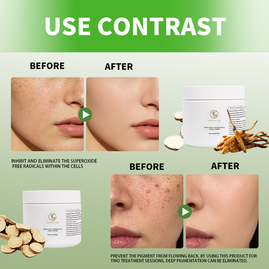 Fan Chu Yan - Dermal Spot Traditional Chinese Medicine Powder