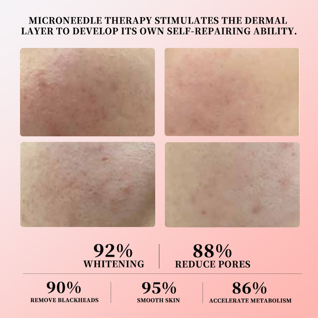 Fan Chu Yan - Youthful Skin Renewal Set